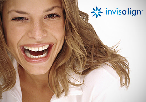 Invisalign® Zahnspange